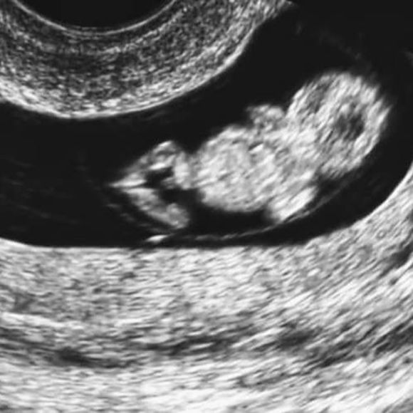 Meet your Posher, Carri - Picture 1 of 1